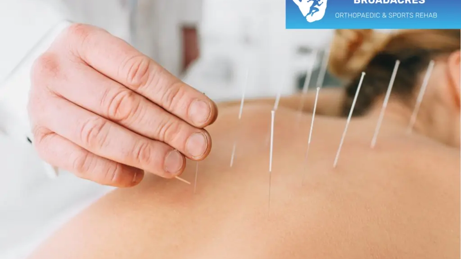 Dry-Needling